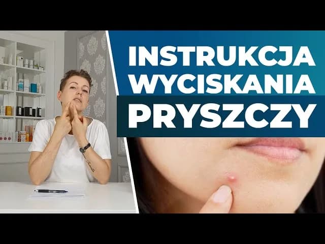 Czy powinno się wyciskać pryszcze? Oto ryzyko i lepsze rozwiązania Czy powinno się wyciskać pryszcze? Oto ryzyko i lepsze rozwiązania